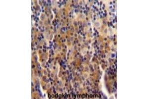 Immunohistochemistry (IHC) image for anti-Chromosome 14 Open Reading Frame 49 (C14orf49) antibody (ABIN2995863) (Nesprin3 anticorps)