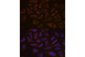 Immunofluorescence analysis of U-2 OS cells using UBE2C Rabbit mAb (ABIN1680590, ABIN3019392, ABIN3019393 and ABIN7101768) at dilution of 1:100 (40x lens).