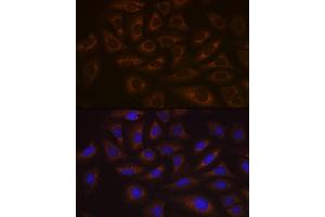 Immunofluorescence analysis of U-2 OS cells using UBE2C Rabbit mAb (ABIN1680590, ABIN3019392, ABIN3019393 and ABIN7101768) at dilution of 1:100 (40x lens). (UBE2C anticorps)