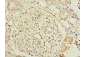 Immunohistochemistry of paraffin-embedded human kidney tissue using ABIN7149924 at dilution of 1:100 (DPYS anticorps  (AA 250-519))