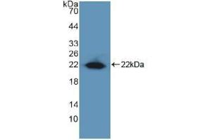 Western blot analysis of recombinant Human EGR1. (EGR1 anticorps  (AA 282-433))