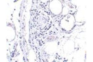 Immunohistochemistry of FABP7 in human breast tissue with FABP7 antibody at 5 μg/ml. (FABP7 anticorps  (Center))