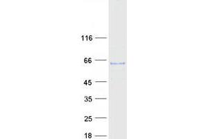 Validation with Western Blot