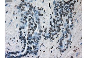 Immunohistochemical staining of paraffin-embedded Kidney tissue using anti-ERCC1 mouse monoclonal antibody. (ERCC1 anticorps)