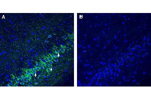 Expression of SLC25A22 in rat hippocampus.