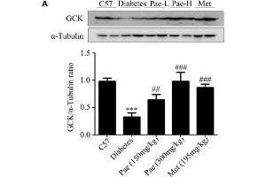 Paeonol upregulated the protein levels of GCK and LDLR and enhanced Akt phosphorylation in animals.