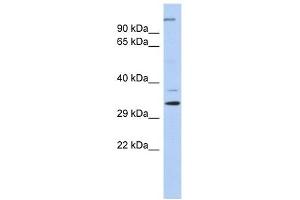 ARPC2 antibody used at 1 ug/ml to detect target protein.