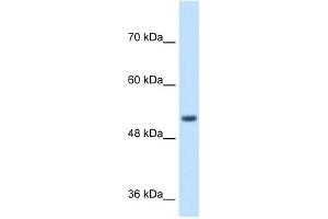 WB Suggested Anti-SPPL2B Antibody Titration:  1 ug/ml  Positive Control:  Jurkat cell lysate SPPL2B is supported by BioGPS gene expression data to be expressed in Jurkat (SPPL2B anticorps  (N-Term))
