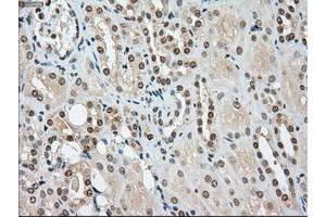 Image no. 6 for anti-Sjogren Syndrome Antigen B (SSB) antibody (ABIN1501146)