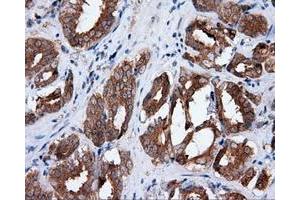 Immunohistochemical staining of paraffin-embedded liver tissue using anti-MTRF1L mouse monoclonal antibody. (MTRF1L anticorps)
