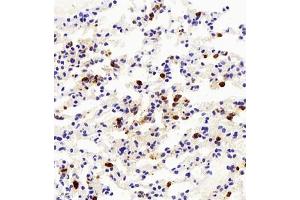 Immunohistochemistry of paraffin embedded mouse lung+LPS using LY6G (ABIN7074524) at dilution of 1:500 (400x lens) (Ly6g anticorps)