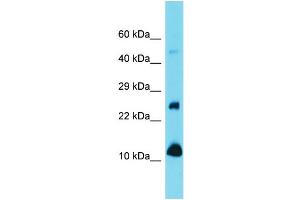 Western Blotting (WB) image for anti-Vesicle-Associated Membrane Protein 1 (Synaptobrevin 1) (VAMP1) (N-Term) antibody (ABIN2789441)