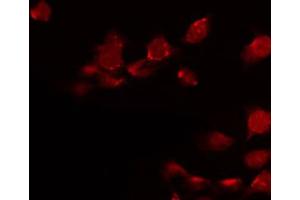 ABIN6272323 staining Hela by IF/ICC.