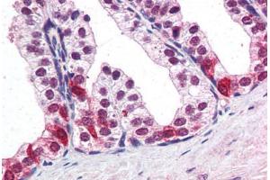 Human Prostate (formalin-fixed, paraffin-embedded) stained with SMARCE1 antibody ABIN351474 at 3. (SMARCE1 anticorps  (AA 364-376))