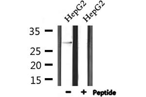 Western blot analysis of extracts from HepG2, using SPIC Antibody. (SPIC anticorps  (Internal Region))