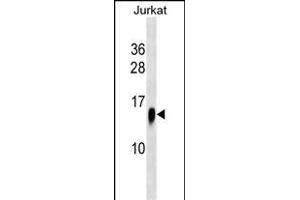 ATP6V1F Antibody (C-term) (ABIN1537610 and ABIN2838177) western blot analysis in Jurkat cell line lysates (35 μg/lane).
