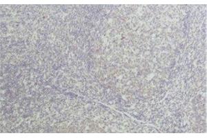 Immunohistochemical analysis of paraffin-embedded Human tonsil tissue using TNF alpha Monoclonal Antibody at dilution of 1:50. (TNF alpha anticorps)