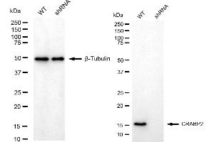 Western blotting analysis using CRABP2 antibody (ABIN7798022).
