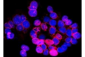 anti-Sad1 and UNC84 Domain Containing 2 (SUN2) (AA 31-695) antibody