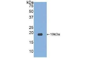 Detection of Recombinant RNASE3, Human using Polyclonal Antibody to Ribonuclease A3 (RNASE3)