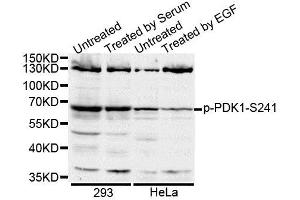 Western blot analysis of extracts of various cell lines, using Phospho-PDK1-S241 antibody (ABIN5995588). (PDPK1 anticorps  (pSer241))