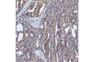 IHC analysis of SFXN5 using anti-SFXN5 antibody (ABIN7601388). (Sideroflexin 5 anticorps  (AA 34-340))
