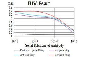 Black line: Control Antigen (100 ng),Purple line: Antigen (10 ng), Blue line: Antigen (50 ng), Red line:Antigen (100 ng) (TH anticorps  (AA 44-208))