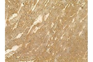 TNNI2 Mouse Monoclonal Antibody at 1/100 staining rat heart tissue by IHC-P. (TNNI2 anticorps)