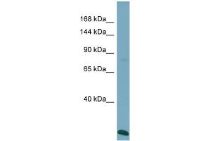 Host:  Rabbit  Target Name:  VPS41  Sample Type:  ACHN Whole Cell lysates  Antibody Dilution:  1. (VPS41 anticorps  (N-Term))