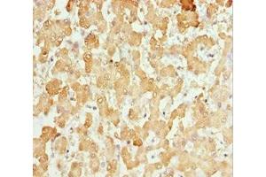 Immunohistochemistry of paraffin-embedded human liver tissue using ABIN7146127 at dilution of 1:100 (CXCL14 anticorps  (AA 35-111))