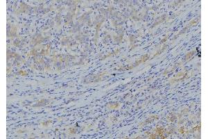ABIN6273365 at 1/100 staining Human gastric tissue by IHC-P. (NDUFA10 anticorps  (C-Term))