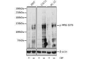 Western blot analysis of extracts of various cell lines, using Phospho-PPIG-S376 antibody (ABIN7269214) at 1:1000 dilution. (PPIG anticorps  (pSer376))