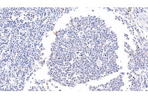 Detection of CD11b in Human Tonsil Tissue using Polyclonal Antibody to Integrin Alpha M (CD11b) (CD11b anticorps  (AA 301-451))