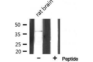 Western blot analysis on rat brain lysate using AOS1 Antibody (SAE1 anticorps  (Internal Region))