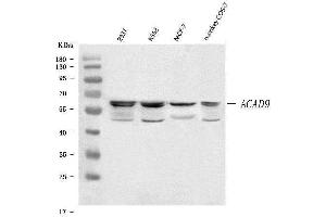 Western blot analysis of ACAD9 using anti-ACAD9 antibody (ABIN7599735).