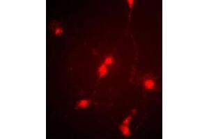 Immunofluorescence image of cultured chick retinal amacrine (neuronal) cells labeled with CLC4 Antibody (C-term) (Cat  f). (CLCN4 anticorps  (C-Term))
