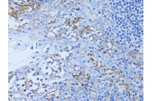 Immunohistochemistry of paraffin-embedded human tonsil using HADH antibody. (HADH anticorps)
