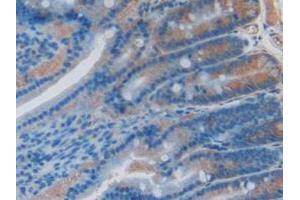 IHC-P analysis of Rat Intestine Tissue, with DAB staining. (PPID anticorps  (AA 7-191))