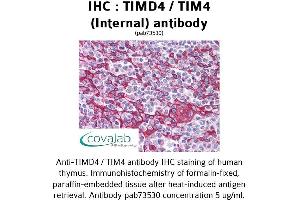 Image no. 2 for anti-T-Cell Immunoglobulin and Mucin Domain Containing 4 (TIMD4) (Internal Region) antibody (ABIN1740078) (TIMD4 anticorps  (Internal Region))