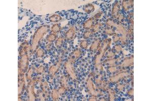 Used in DAB staining on fromalin fixed paraffin- embedded kidney tissue (MMP23A anticorps  (AA 71-383))