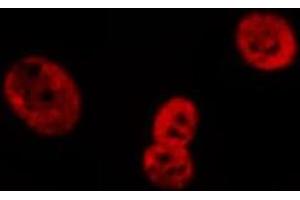 ABIN6269079 staining HeLa cells by IF/ICC. (Lamin A/C anticorps  (Internal Region))