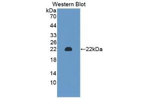 Detection of Recombinant CHGA, Mouse using Polyclonal Antibody to Chromogranin A (CHGA)