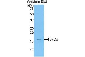 Detection of Recombinant HMGA2, Human using Polyclonal Antibody to High Mobility Group AT Hook Protein 2 (HMGA2) (HMGA2 anticorps  (AA 1-109))