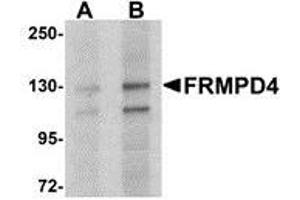 Western blot analysis of FRMPD4 in SK-N-SH cell lysate with AP30349PU-N FRMPD4 antibody at (A) 1 and (B) 2 μg/ml.