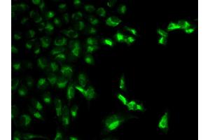 Immunofluorescence analysis of MCF-7 cell using FCGR1A antibody. (FCGR1A anticorps  (AA 200-292))