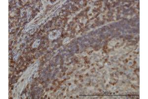 Immunoperoxidase of monoclonal antibody to DEF6 on formalin-fixed paraffin-embedded human lymph node [antibody concentration 3 ug/ml]