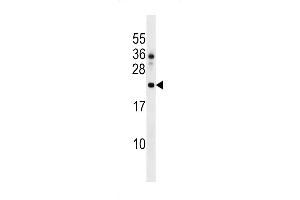 Western blot analysis in HL-60 cell line lysates (35ug/lane).