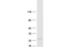 Validation with Western Blot