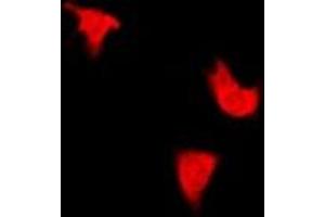 Immunofluorescent analysis of IRS1 (pS312) staining in HepG2 cells.