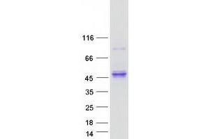 Validation with Western Blot